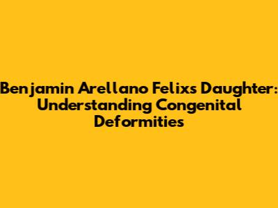 Benjamin Arellano Felix's Daughter: Understanding Congenital Deformities