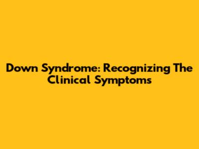 Down Syndrome: Recognizing The Clinical Symptoms