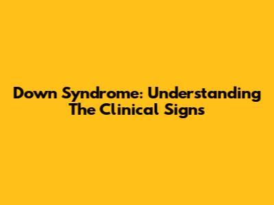 Down Syndrome: Understanding The Clinical Signs