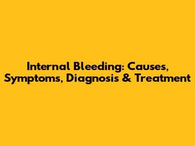 Internal Bleeding: Causes, Symptoms, Diagnosis & Treatment