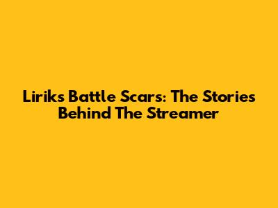 Lirik's Battle Scars: The Stories Behind The Streamer
