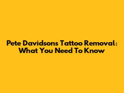 Pete Davidson's Tattoo Removal: What You Need To Know
