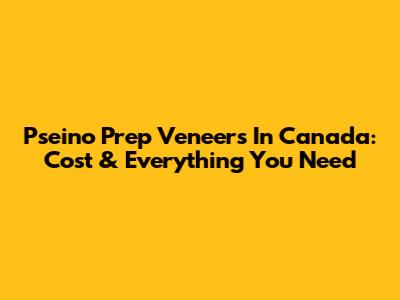 Pseino Prep Veneers In Canada: Cost & Everything You Need